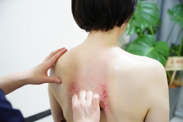 かっさ